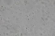 semen和sperm的区别? (semen和sperm的区别)
