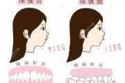 有什么方法覆灭蜘蛛 (有什么方法覆盖一个人)