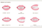 ENS失误代码